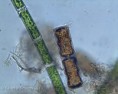 /album/galleria-foto-protisti/microscopia-9-jpg/